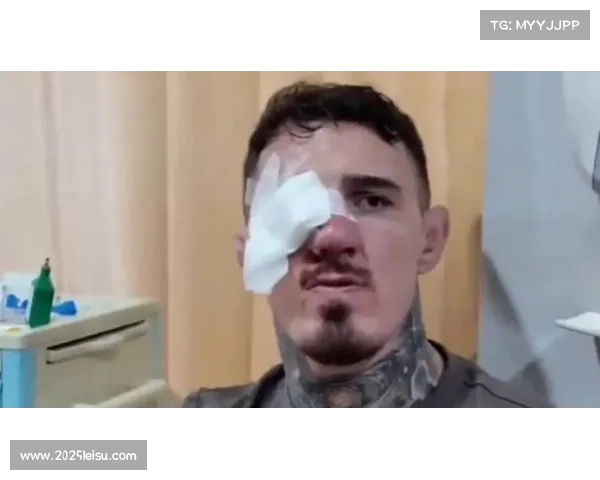 阿斯皮纳尔澄清UFC321退赛原因：视力受损无法继续